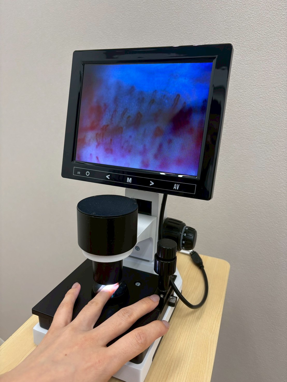 毛細血管検査の様子